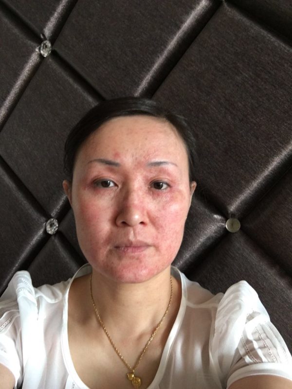 图片[2]-新疆美容院的王老师，喝醋蛋液她的肌肤变化，大变活人，昨天在她们美容院群里分享到快1点，激动的呀-醋蛋液案例交流分享圈子社区-智健家