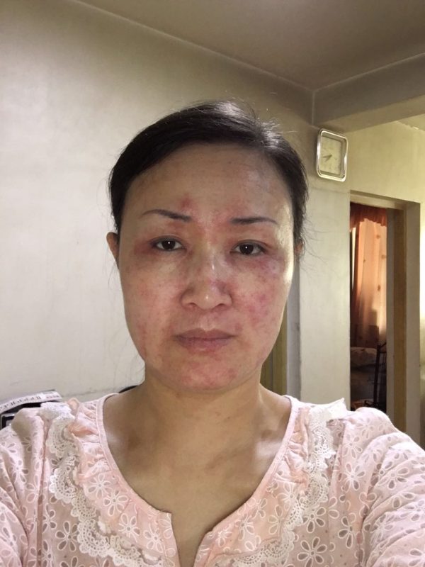 图片[3]-新疆美容院的王老师，喝醋蛋液她的肌肤变化，大变活人，昨天在她们美容院群里分享到快1点，激动的呀-醋蛋液案例交流分享圈子社区-智健家