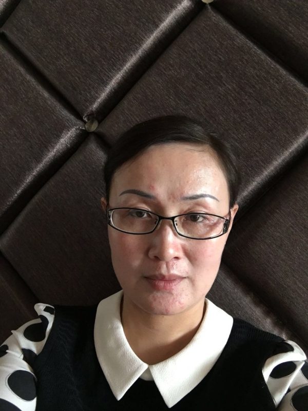 图片[4]-新疆美容院的王老师，喝醋蛋液她的肌肤变化，大变活人，昨天在她们美容院群里分享到快1点，激动的呀-醋蛋液案例交流分享圈子社区-智健家