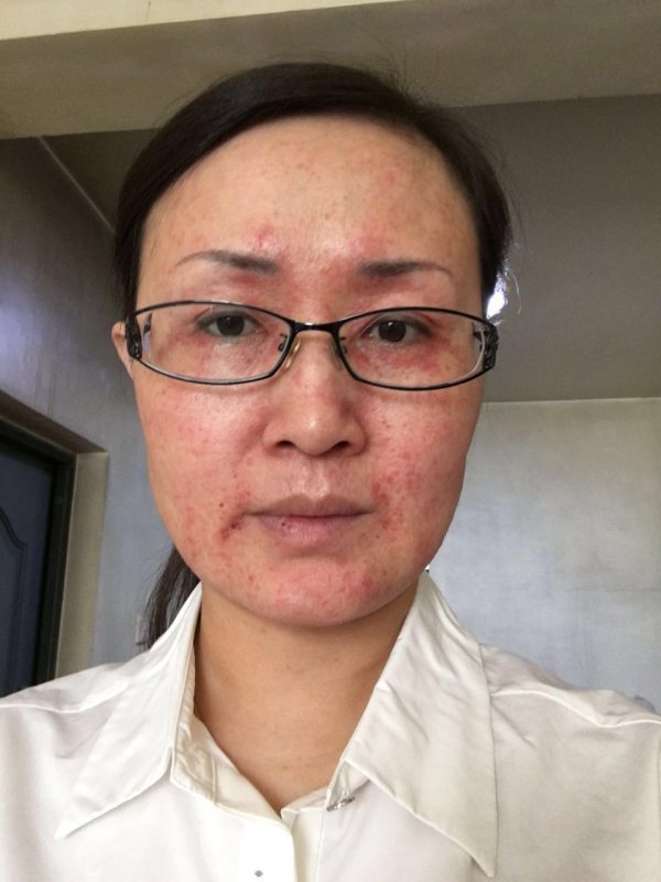 图片[5]-新疆美容院的王老师，喝醋蛋液她的肌肤变化，大变活人，昨天在她们美容院群里分享到快1点，激动的呀-醋蛋液案例交流分享圈子社区-智健家