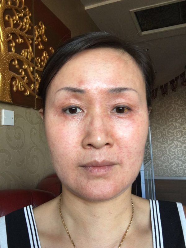 图片[6]-新疆美容院的王老师，喝醋蛋液她的肌肤变化，大变活人，昨天在她们美容院群里分享到快1点，激动的呀-醋蛋液案例交流分享圈子社区-智健家