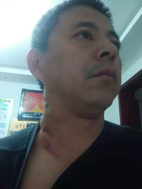 图片[5]-淋巴结节 喝泰谦堂醋蛋归元液两个疗程的结果-醋蛋液案例交流分享圈子社区-智健家