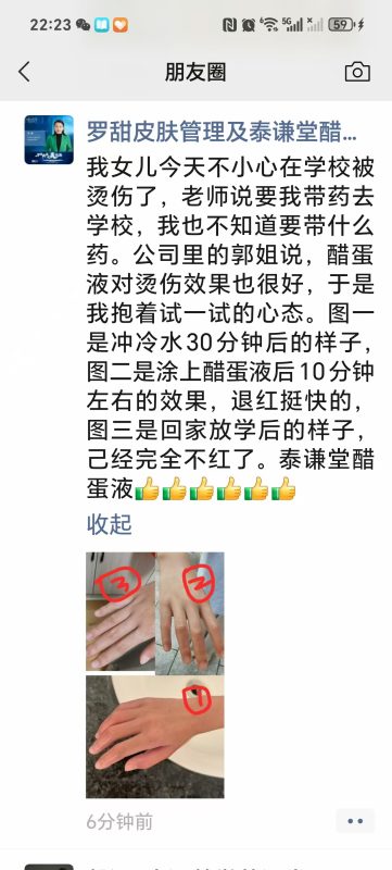图片[1]-醋蛋液对烫伤的效果也挺好的-醋蛋液案例交流分享圈子社区-智健家