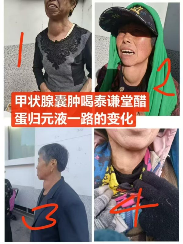 图片[1]-甲状腺囊肿喝泰谦堂醋蛋归元液一路的变化-醋蛋液案例交流分享圈子社区-智健家