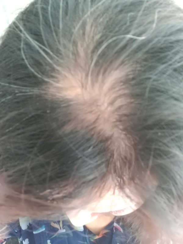 图片[1]-白发转黑发：服用泰谦堂醋蛋液一年半的神奇效果，不得不服！-醋蛋液案例交流分享圈子社区-智健家