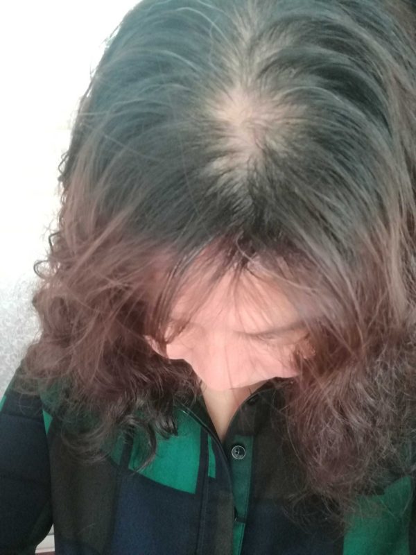 图片[2]-白发转黑发：服用泰谦堂醋蛋液一年半的神奇效果，不得不服！-醋蛋液案例交流分享圈子社区-智健家