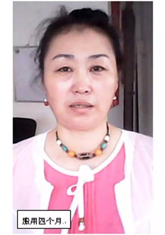 图片[3]-来自东北的照金鸿老师，曾经常年做屋顶防水处理，导致皮肤严重过敏等情况，醋蛋归元液服用7个月后完全恢复了正常。-醋蛋液案例交流分享圈子社区-智健家