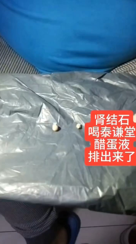 图片[1]-【视频】肾结石 喝泰谦堂醋蛋归元液 排出来了 -醋蛋液案例交流分享圈子社区-智健家