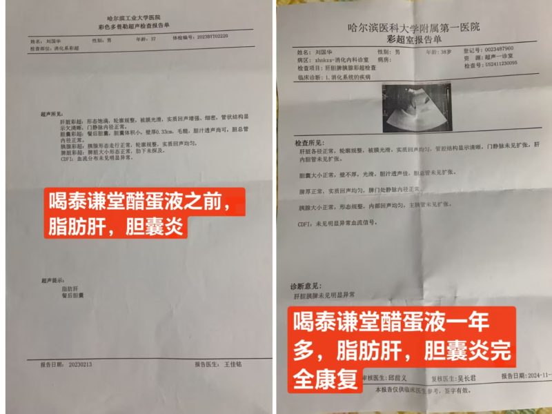 图片[1]-喝泰谦堂醋蛋液一年多，脂肪肝 胆囊炎完全康复-醋蛋液案例交流分享圈子社区-智健家