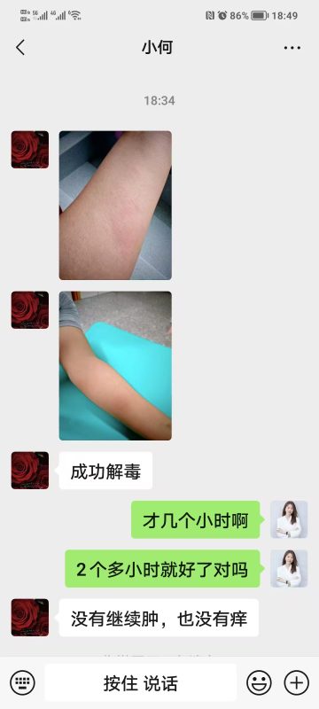 图片[2]-蚊虫叮咬，咬的大包，涂抹泰谦堂醋蛋液，2个多小时后快速解毒的效果-醋蛋液案例交流分享圈子社区-智健家