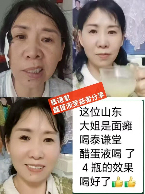 图片[1]-山东大姐是面瘫，喝泰谦堂醋蛋液4瓶的效果-醋蛋液案例交流分享圈子社区-智健家