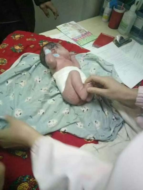 图片[1]-双胞胎泰谦堂醋蛋宝宝出生了 爸妈结婚五年未孕，没有孕酮，到处求医问药 喝醋蛋液6瓶怀孕双胞胎-醋蛋液案例交流分享圈子社区-智健家