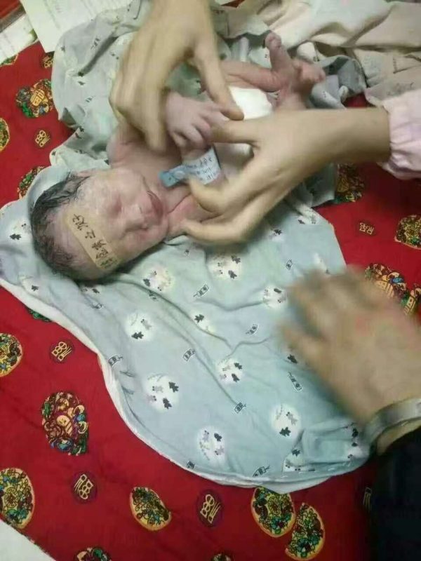 图片[2]-双胞胎泰谦堂醋蛋宝宝出生了 爸妈结婚五年未孕，没有孕酮，到处求医问药 喝醋蛋液6瓶怀孕双胞胎-醋蛋液案例交流分享圈子社区-智健家