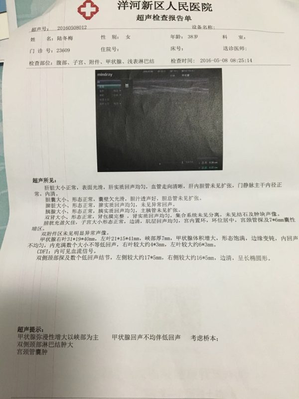 图片[5]-我是桥本氏甲减，服用优甲乐2个多月，泰谦堂醋蛋液断断续续喝了3瓶，我的指标是正常了，这是我的医院检查报告。-醋蛋液案例交流分享圈子社区-智健家