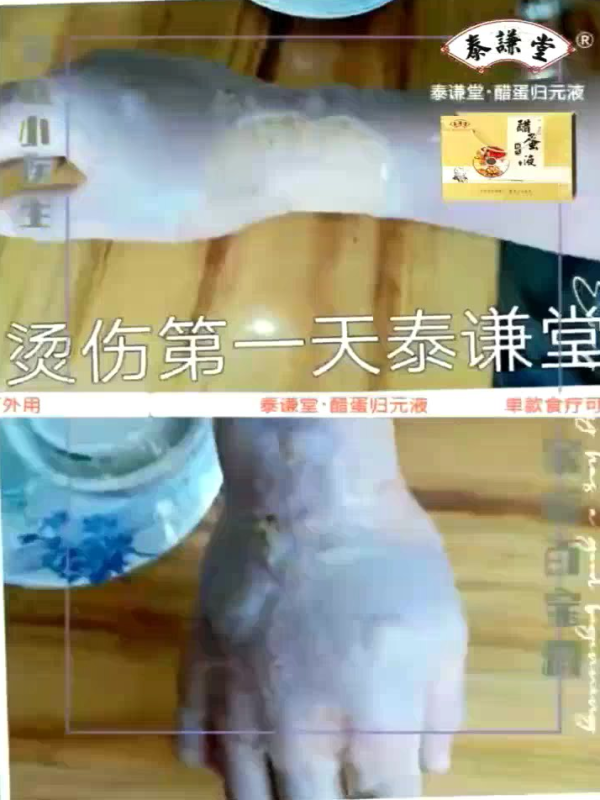 图片[1]-【视频】烫伤 使用泰谦堂醋蛋归元液18天后的受益者-醋蛋液案例交流分享圈子社区-智健家