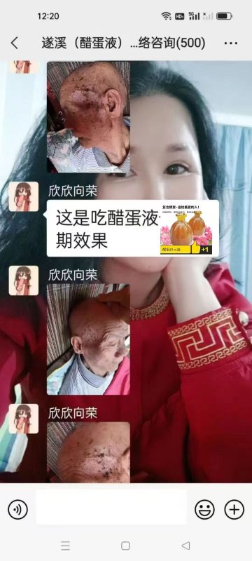 图片[1]-醋蛋液对老年斑的效果非常好，醋蛋液是美容佳品啊，年轻10岁不是梦！-醋蛋液案例交流分享圈子社区-智健家