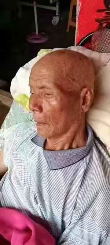 图片[3]-醋蛋液对老年斑的效果非常好，醋蛋液是美容佳品啊，年轻10岁不是梦！-醋蛋液案例交流分享圈子社区-智健家