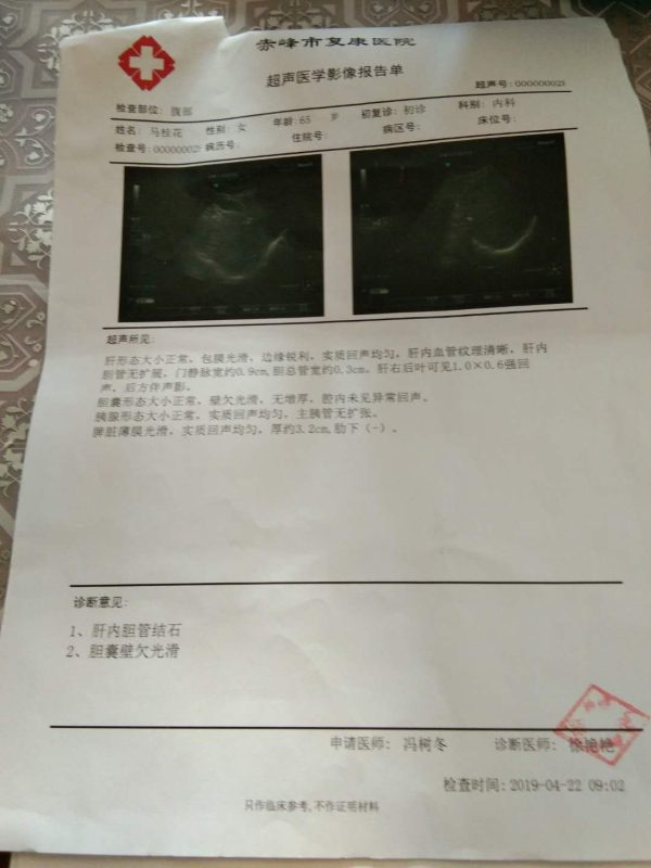 图片[1]-马姐是胆管结石，喝泰谦堂醋蛋液7个月做的彩超，喝没有了-醋蛋液案例交流分享圈子社区-智健家