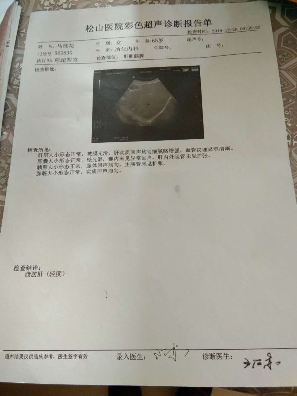 图片[2]-马姐是胆管结石，喝泰谦堂醋蛋液7个月做的彩超，喝没有了-醋蛋液案例交流分享圈子社区-智健家