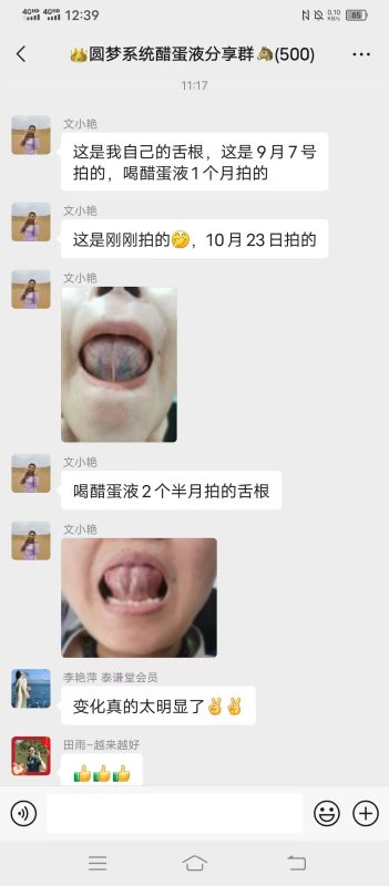 图片[1]-没喝醋蛋液之前，舌根两条很黑很粗的黑筋，喝醋蛋液2个半月，现在通畅了-醋蛋液案例交流分享圈子社区-智健家