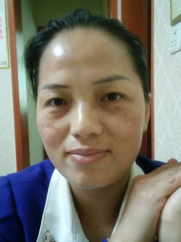 图片[2]-喝泰谦堂醋蛋液到现在15瓶，淡黑斑 嘴也斜了 失眠也好了 口臭消失了 困扰多年湿疹也好了 人精气神越来越好-醋蛋液案例交流分享圈子社区-智健家