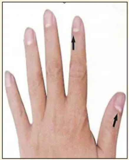 图片[10]-10分钟学会看手诊病-智健家