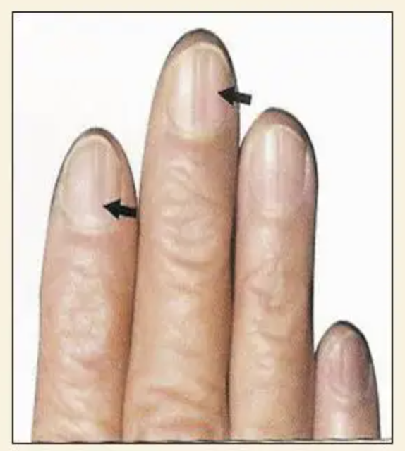 图片[11]-10分钟学会看手诊病-智健家