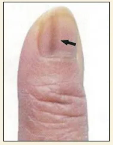 图片[12]-10分钟学会看手诊病-智健家