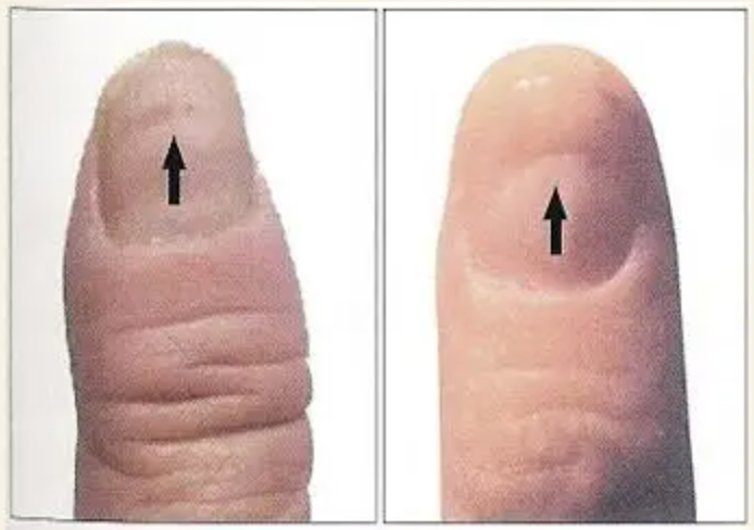 图片[13]-10分钟学会看手诊病-智健家