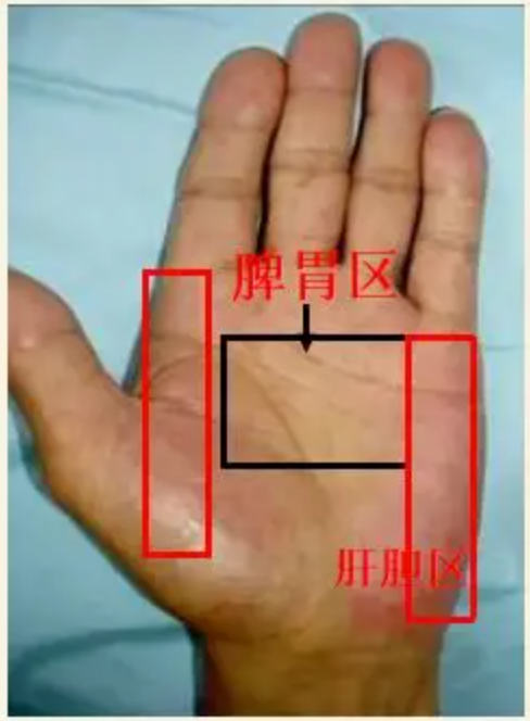 图片[14]-10分钟学会看手诊病-智健家