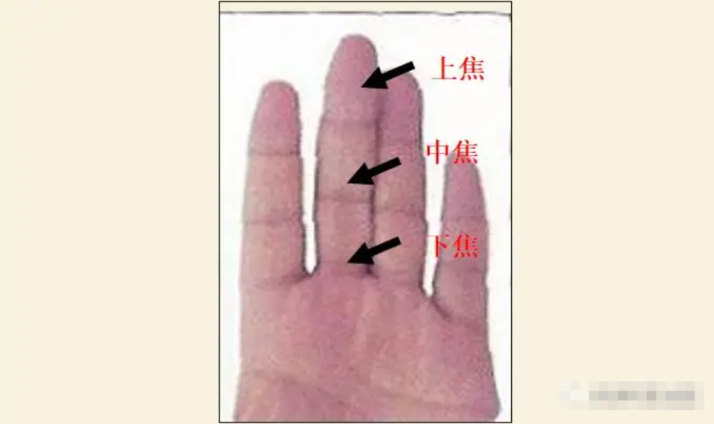 图片[2]-10分钟学会看手诊病-智健家