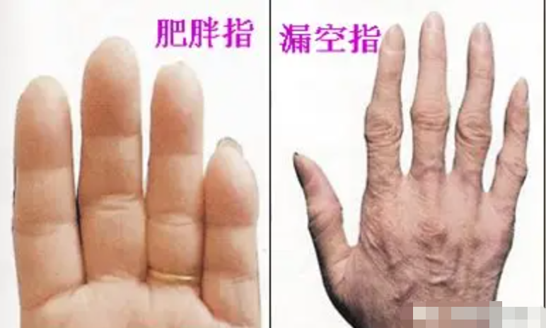 图片[5]-10分钟学会看手诊病-智健家