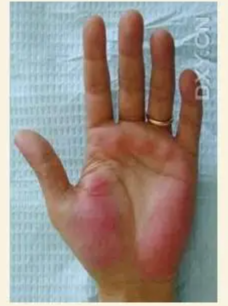 图片[7]-10分钟学会看手诊病-智健家