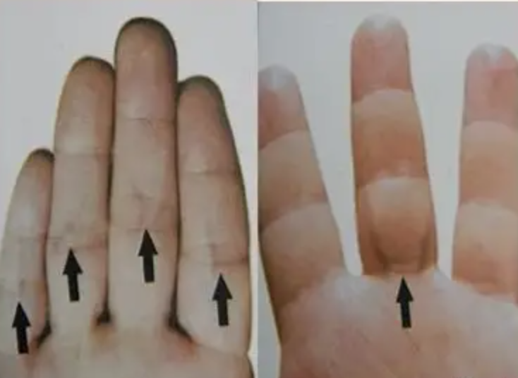 图片[8]-10分钟学会看手诊病-智健家