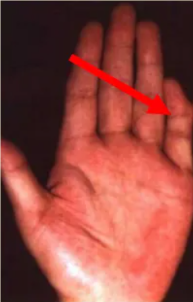 图片[9]-10分钟学会看手诊病-智健家