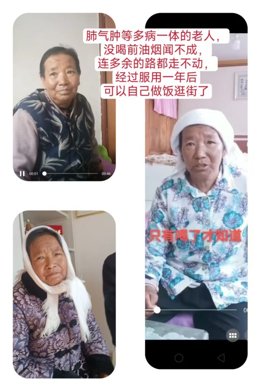 肺气肿等一体多病的老人，服用醋蛋液后前后对比-智健家