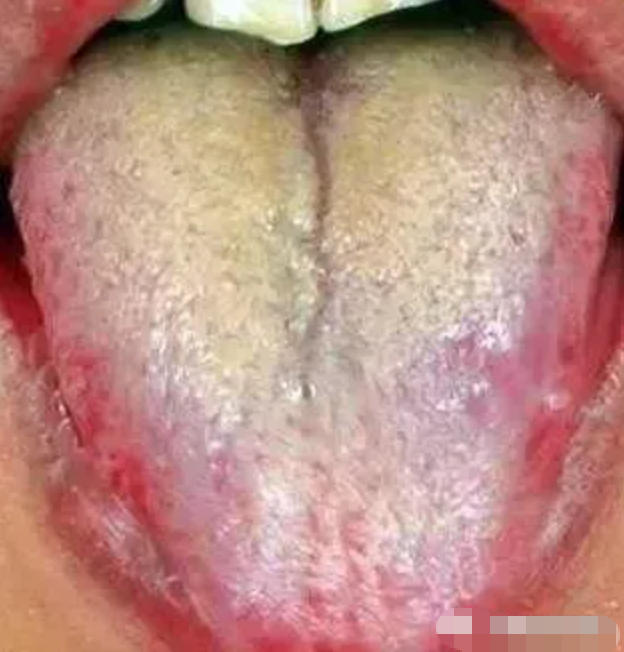 图片[10]-10分钟看懂自己舌像-智健家