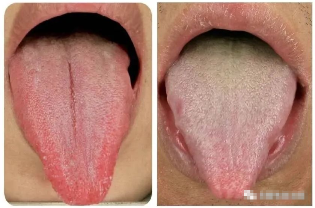 图片[11]-10分钟看懂自己舌像-智健家