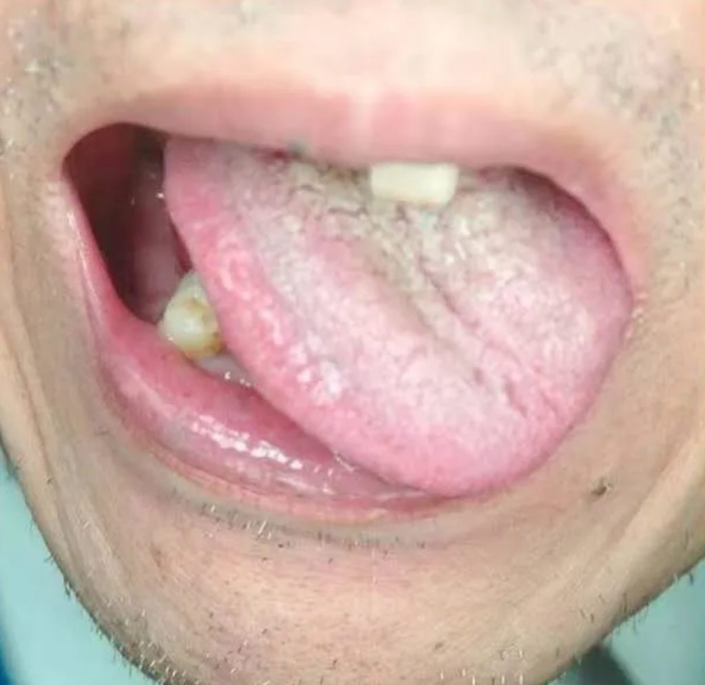 图片[12]-10分钟看懂自己舌像-智健家