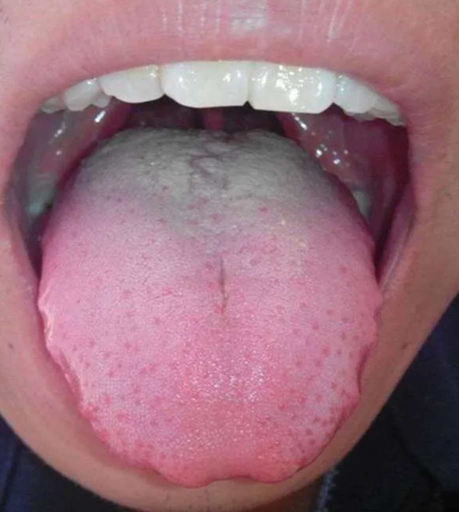 图片[13]-10分钟看懂自己舌像-智健家