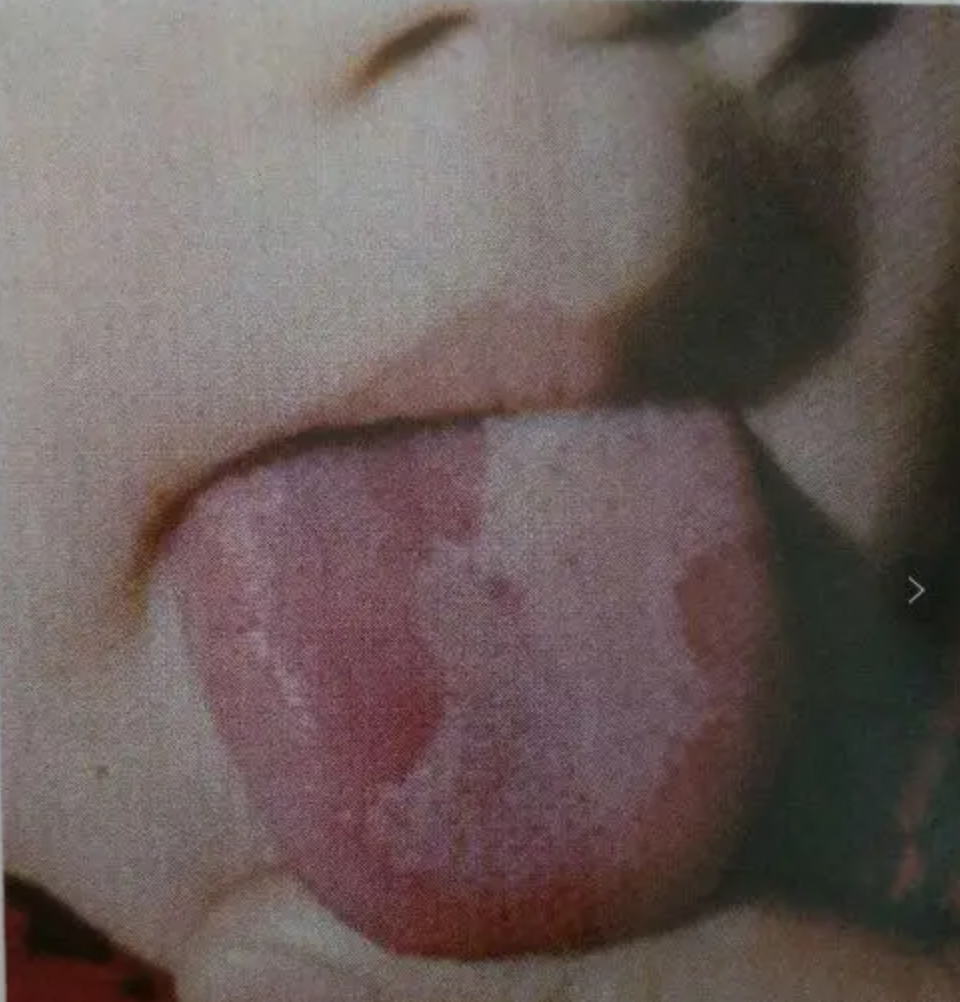 图片[14]-10分钟看懂自己舌像-智健家