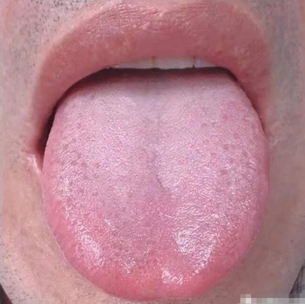 图片[2]-10分钟看懂自己舌像-智健家