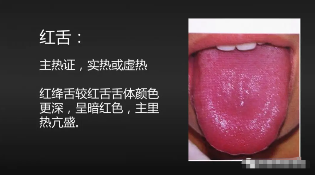 图片[3]-10分钟看懂自己舌像-智健家