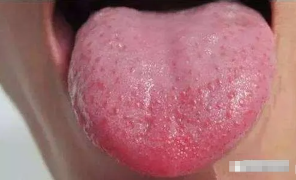 图片[4]-10分钟看懂自己舌像-智健家