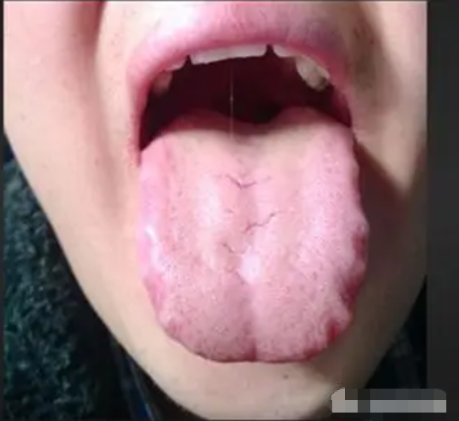 图片[5]-10分钟看懂自己舌像-智健家