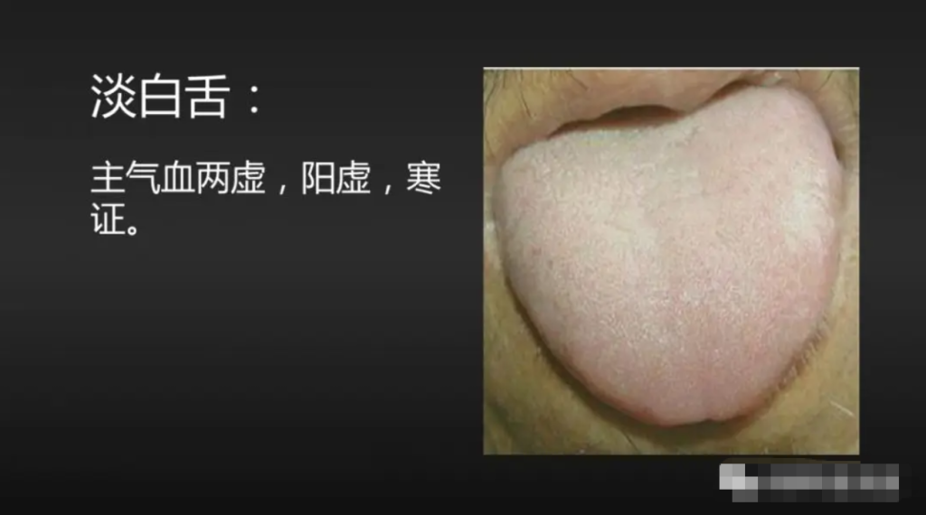 图片[6]-10分钟看懂自己舌像-智健家