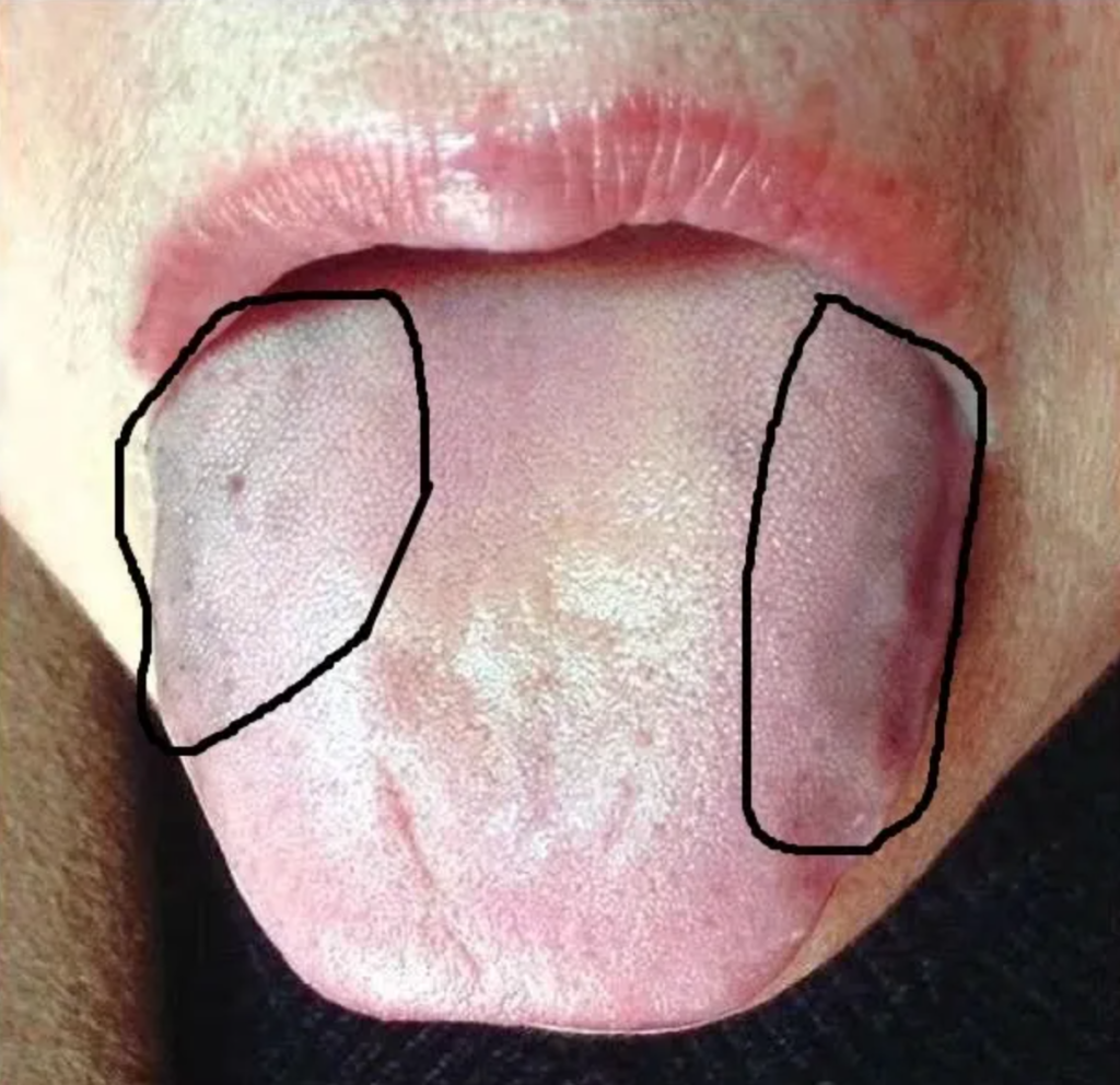 图片[7]-10分钟看懂自己舌像-智健家