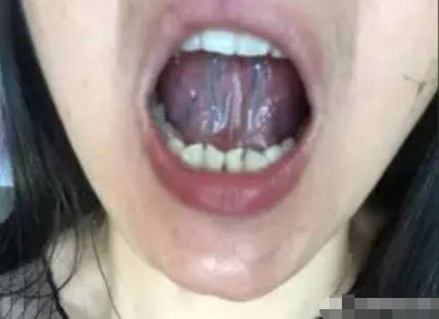 图片[8]-10分钟看懂自己舌像-智健家