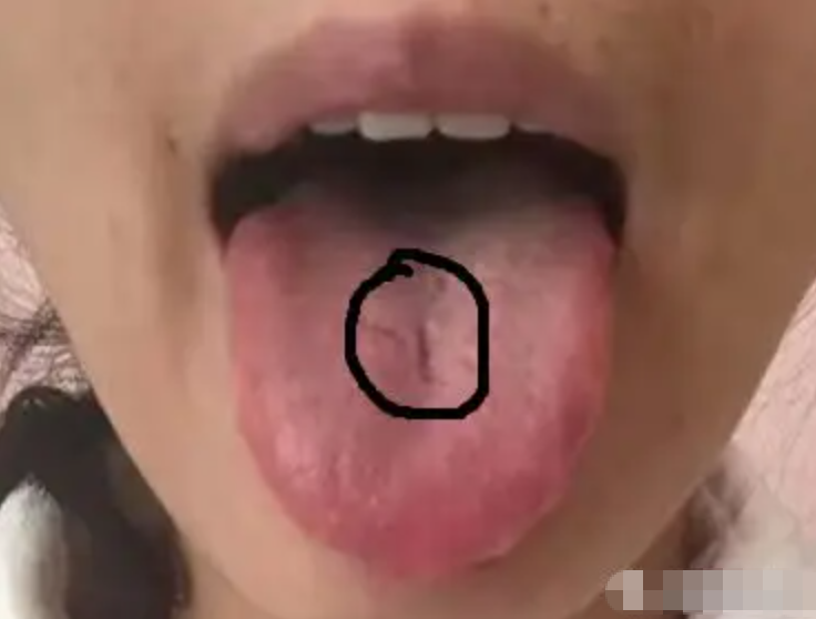 图片[9]-10分钟看懂自己舌像-智健家