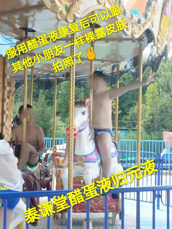 图片[11]-【视频】儿子那年才12岁😭 银屑病（牛皮癣）〔小小醋蛋液，十五天有效，三个月痊愈〕-泰谦堂醋蛋液案例合集圈子社区-智健家